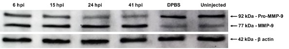 Western blot analysis of pro-MMP-9.jpg